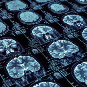 MRI scan wallpaper mural
